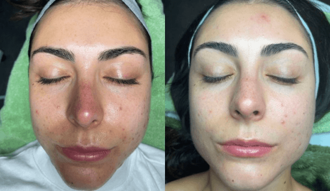 Philadelphia Facial Plastic Surgery & Med Spa